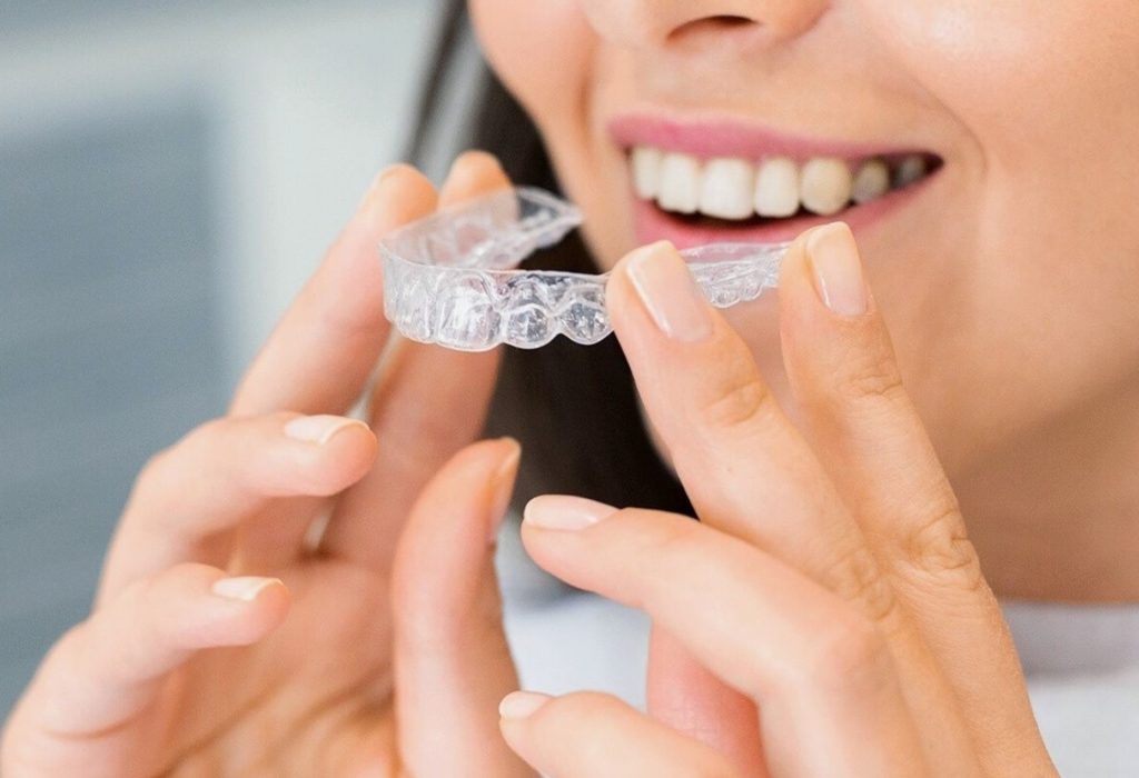 Invisalign Tips and Tricks