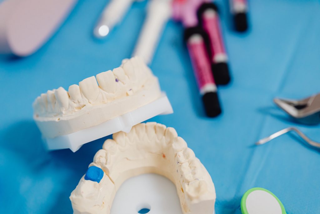 Benefits of Invisalign over Traditional Braces