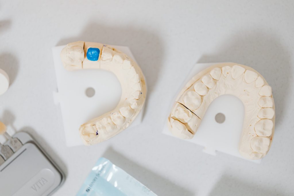 Looking for orthodontic treatment alternatives to Invisalign? This blog post covers the best options available including traditional braces, clear aligners, retainers, and veneers. Learn about the pros and cons of each treatment and find out which one may be best for your specific case.